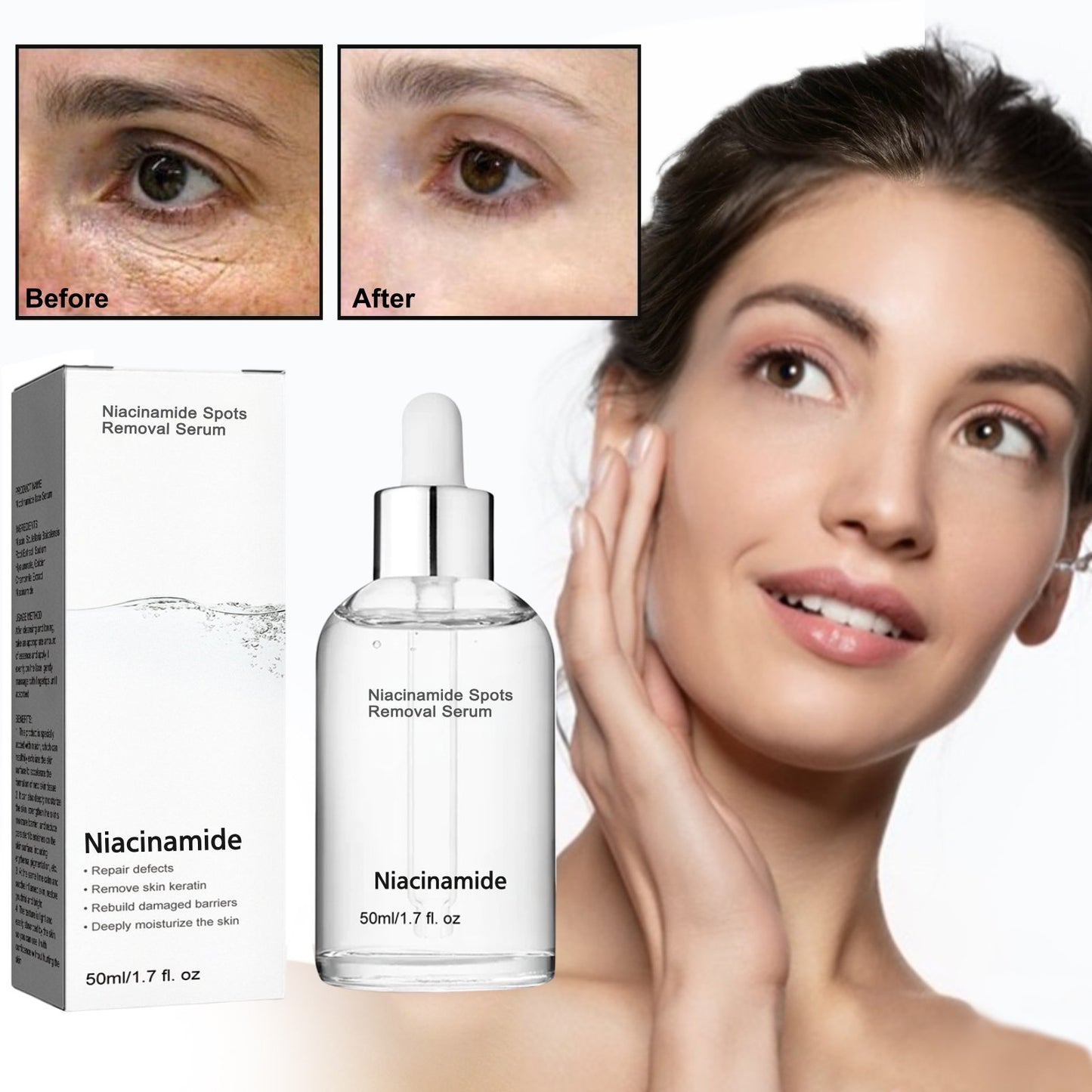 🎉Buy One Get One Free🎁 - Niacinamide Spots Removal Serum